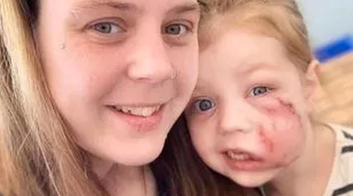 Young girl receives lifetime scar after dog attack amid call for breed ban